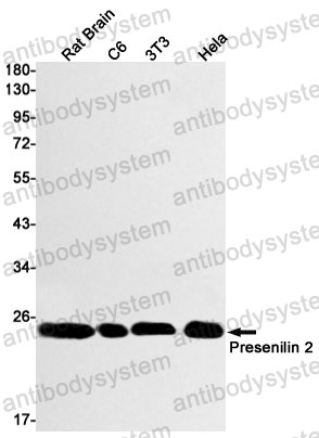 Anti-PSEN2/Presenilin-2 Antibody (R1X77)