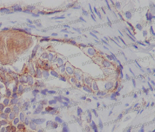Anti-TSC2 Antibody (R1X78)