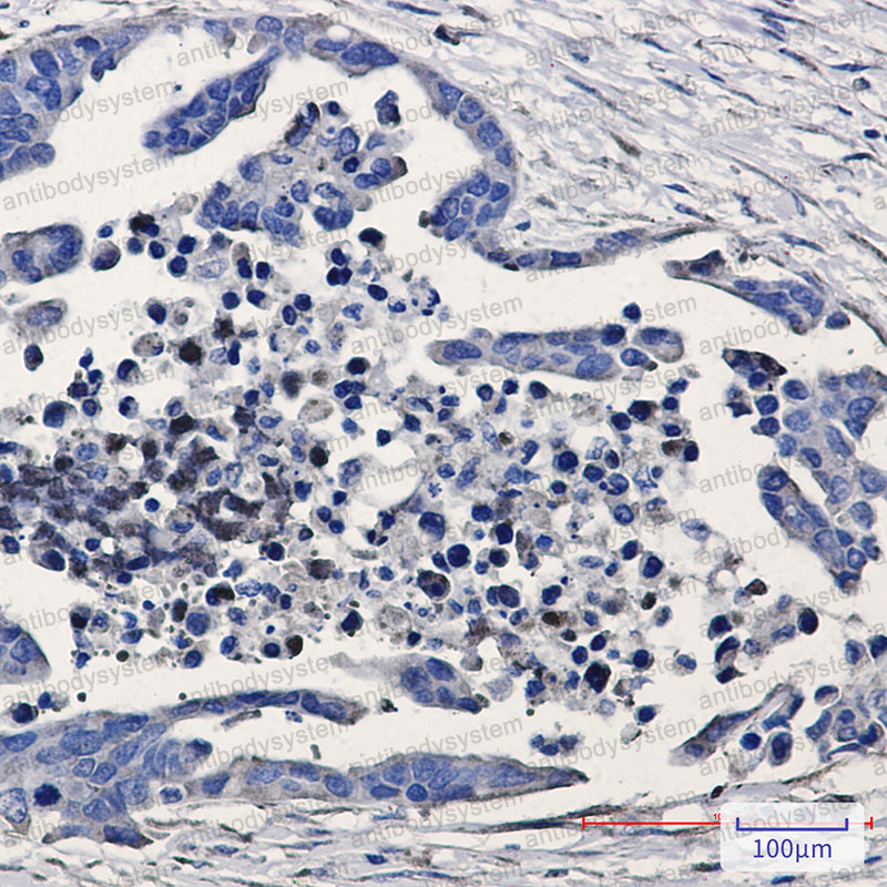 Anti-GSK3B Antibody (R1X87)