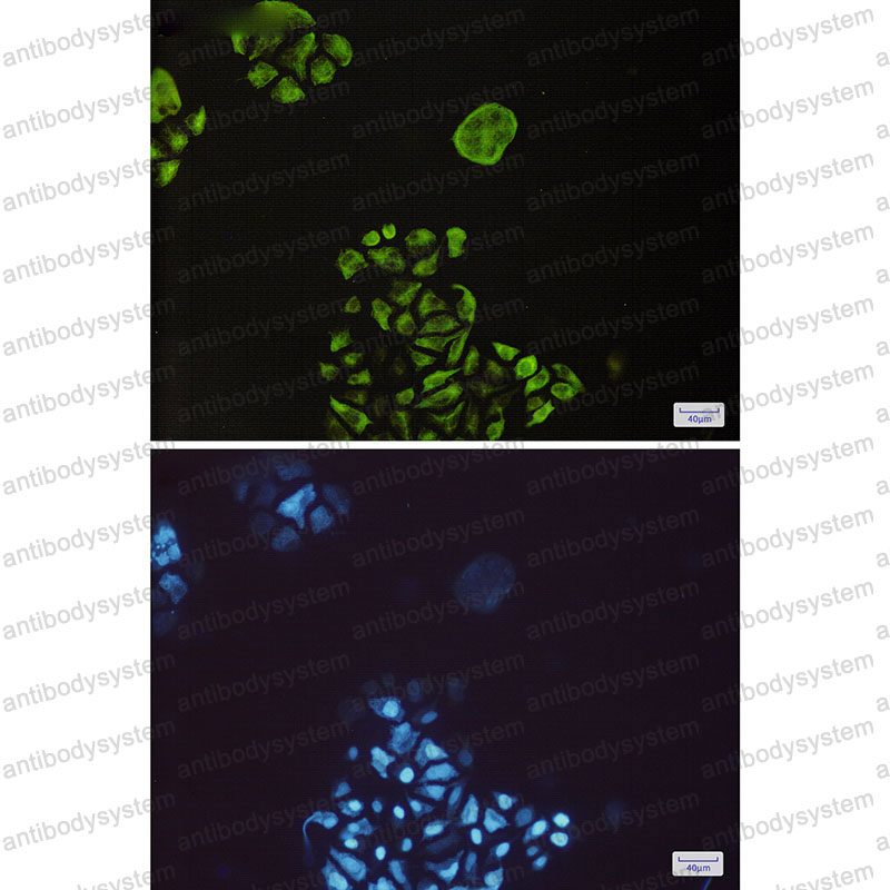 Anti-Phospho-GSK3B (Ser9) Antibody (R1X86)