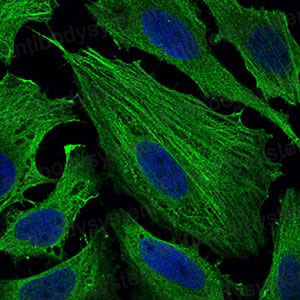 Immunofluorescence for Anti-SMCP Antibody (R3M15) ?>