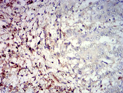Immunohistochemical for Anti-CD39/ENTPD1 Antibody (R3M20) ?>