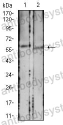 Anti-CD39/ENTPD1 Antibody (R3M21)