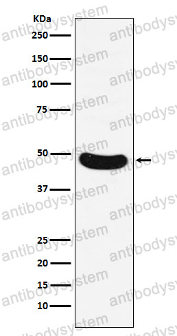 Anti-HB9/HLXB9 Antibody (R1X98)