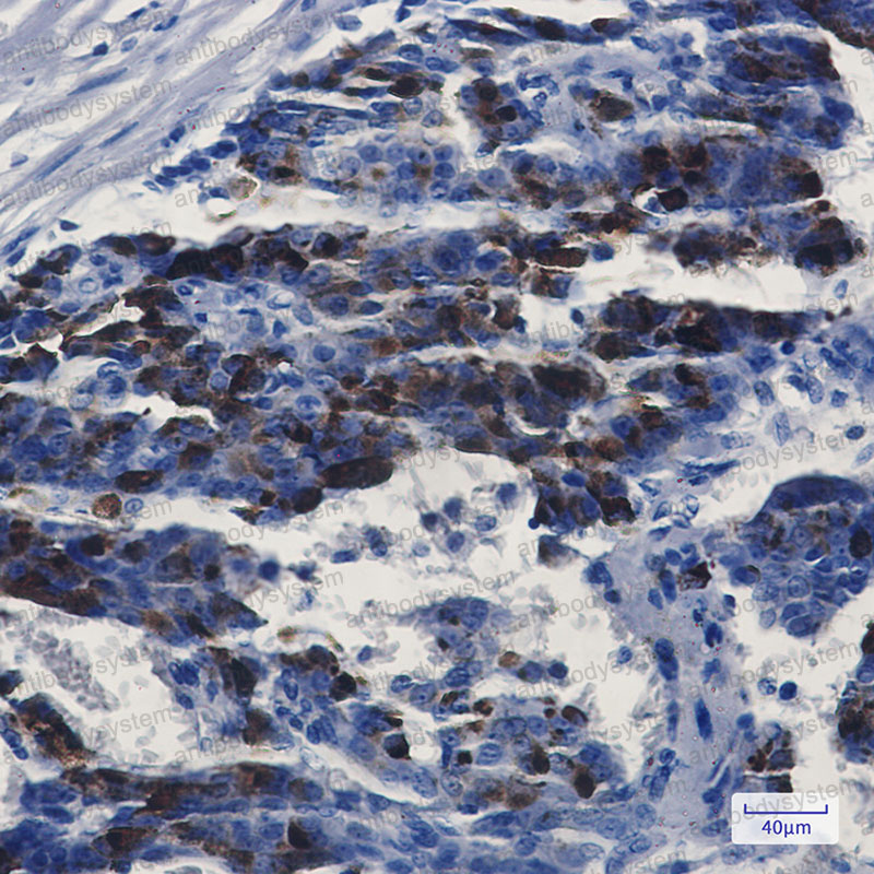 Anti-MMP14 Antibody (R1X99)
