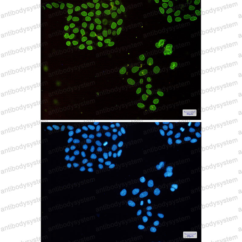 Anti-EMD Antibody (R1Y01)