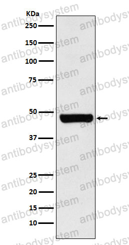 Anti-ST13 Antibody (R1Y03)