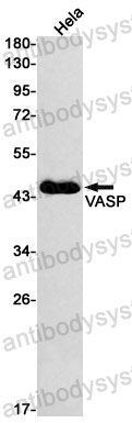 Anti-VASP Antibody (R1Y04)