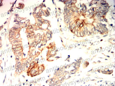 Immunohistochemical for Anti-VASP Antibody (R3M33) ?>