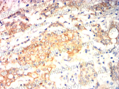 Immunohistochemical for Anti-VASP Antibody (R3M33) ?>