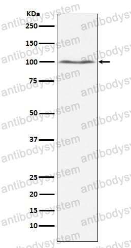 Anti-DNM2 Antibody (R1Y05)