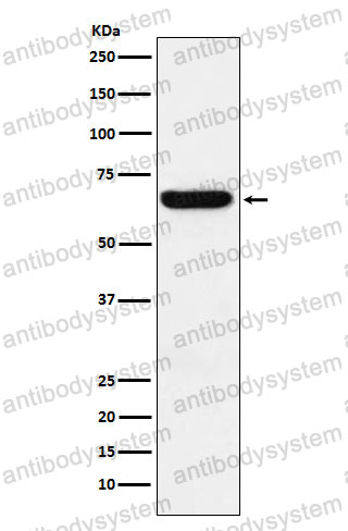 Anti-METAP2 Antibody (R1Y06)