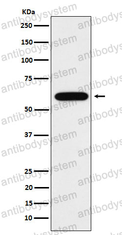 Anti-TUB Antibody (R1Y07)