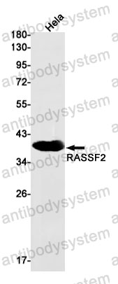 Anti-RASSF2 Antibody (R1Y10)