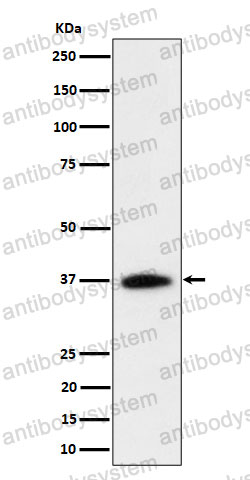 Anti-RASSF2 Antibody (R1Y09)