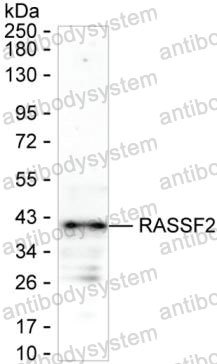 Western blot for Anti-RASSF2 Antibody (R3M38) ?>