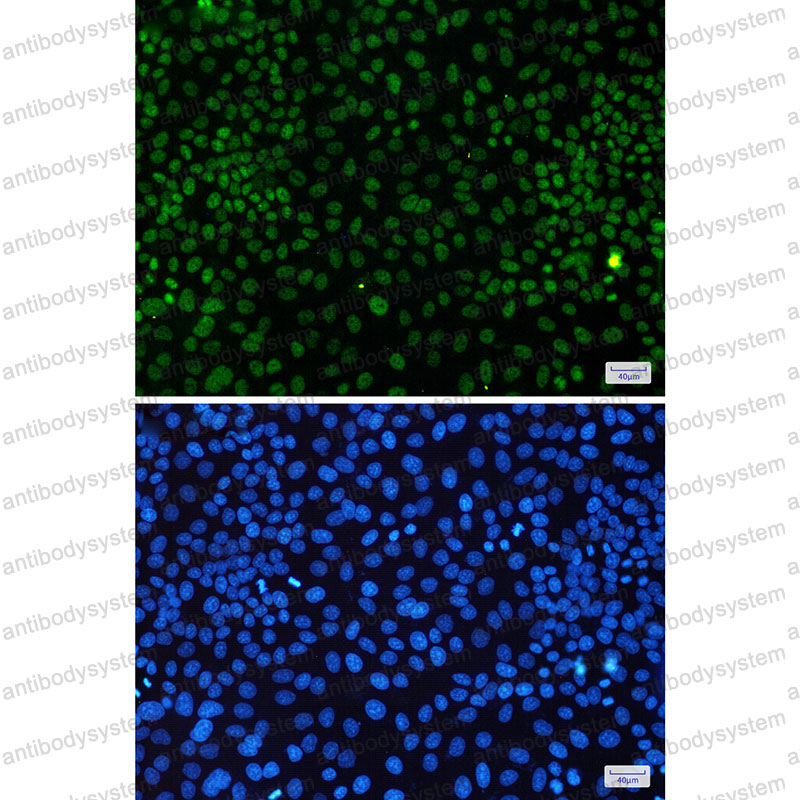 Anti-CDK9 Antibody (R1Y11)
