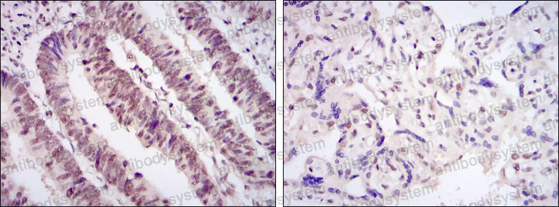 Immunohistochemical for Anti-CDK9 Antibody (R3M39) ?>