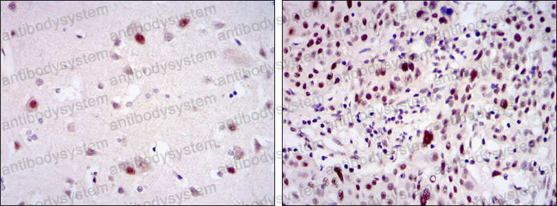 Immunohistochemical for Anti-CDK9 Antibody (R3M39) ?>