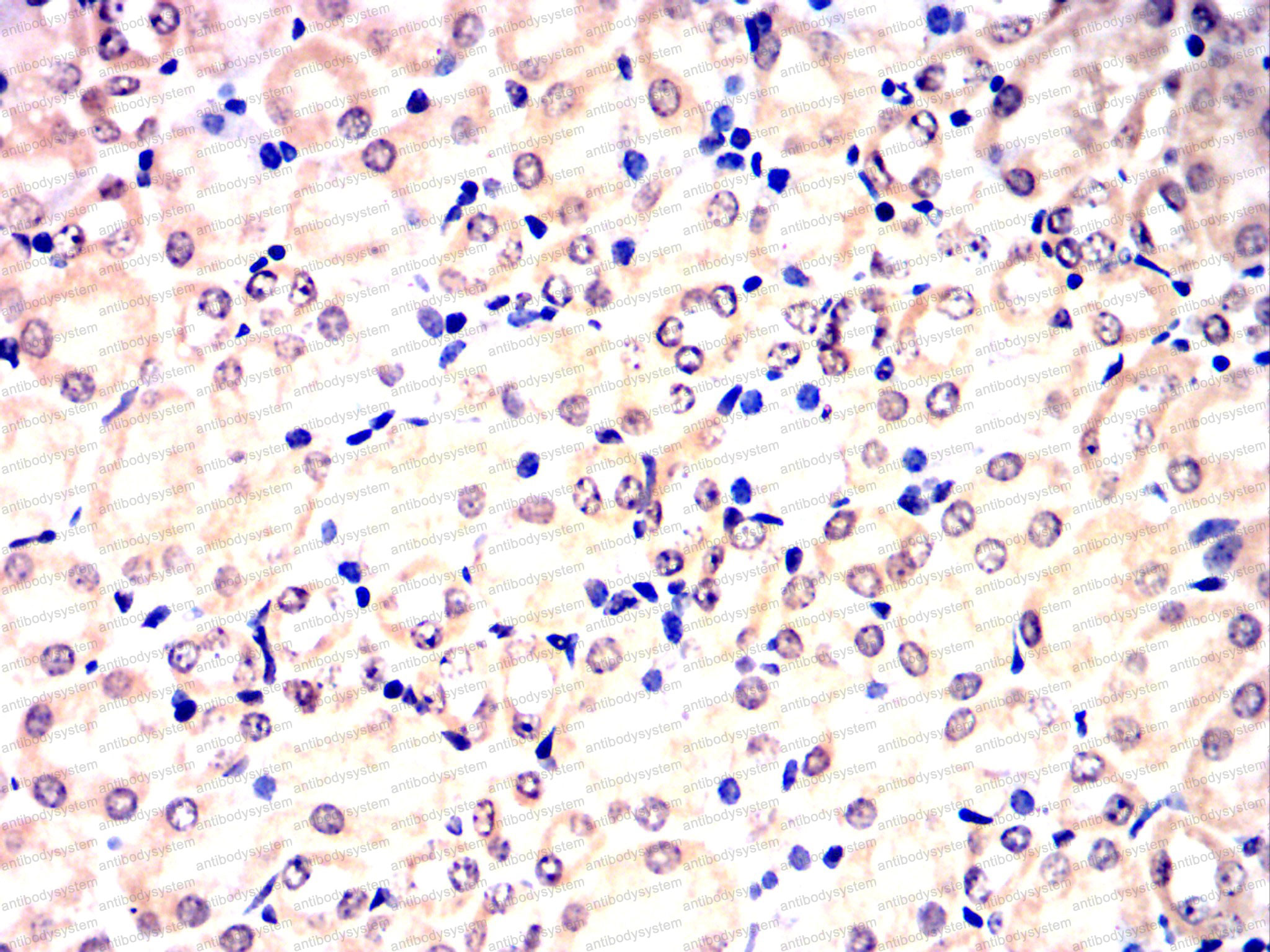 Immunohistochemical for Anti-CDK9 Antibody (R3M39) ?>