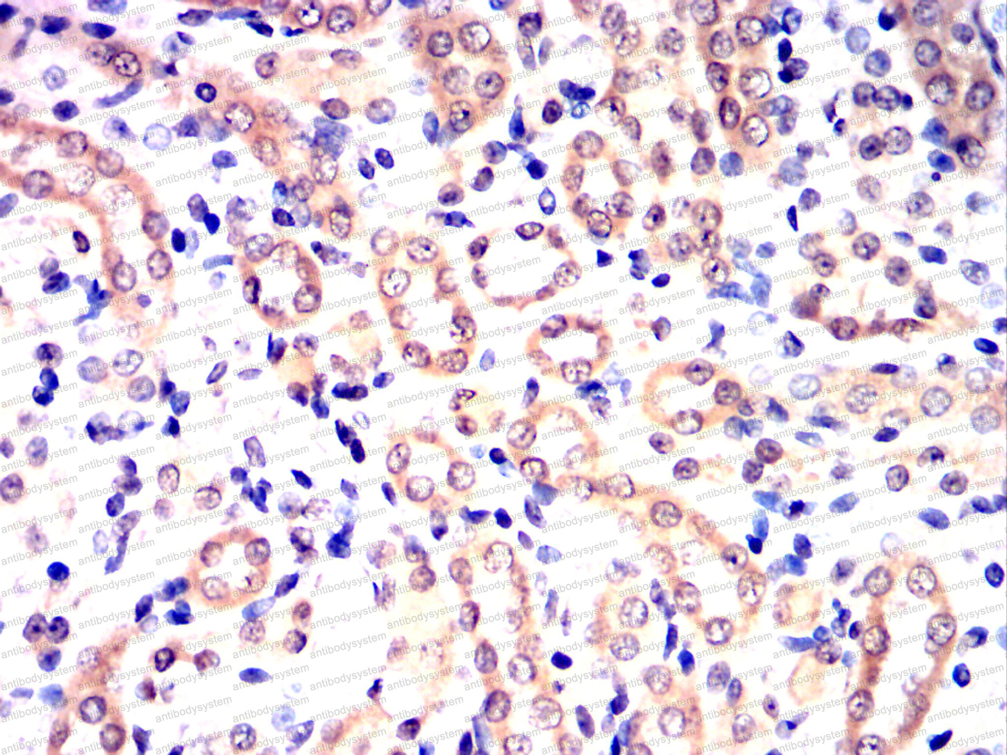 Immunohistochemical for Anti-CDK9 Antibody (R3M39) ?>