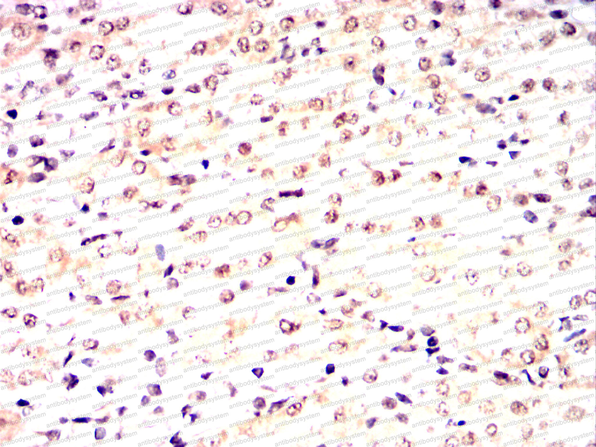 Immunohistochemical for Anti-CDK9 Antibody (R3M39) ?>