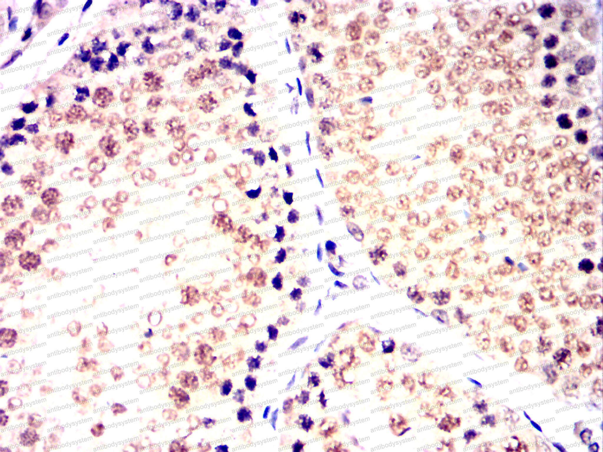Immunohistochemical for Anti-CDK9 Antibody (R3M39) ?>