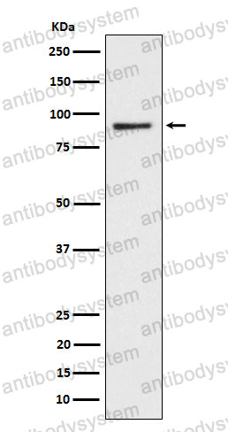 Anti-CD239/BCAM Antibody (R1Y12)