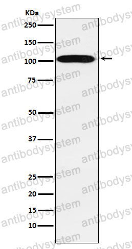 Anti-ATP1A2 Antibody (R1Y13)