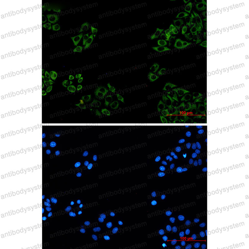 Anti-FXR1 Antibody (R1Y15)
