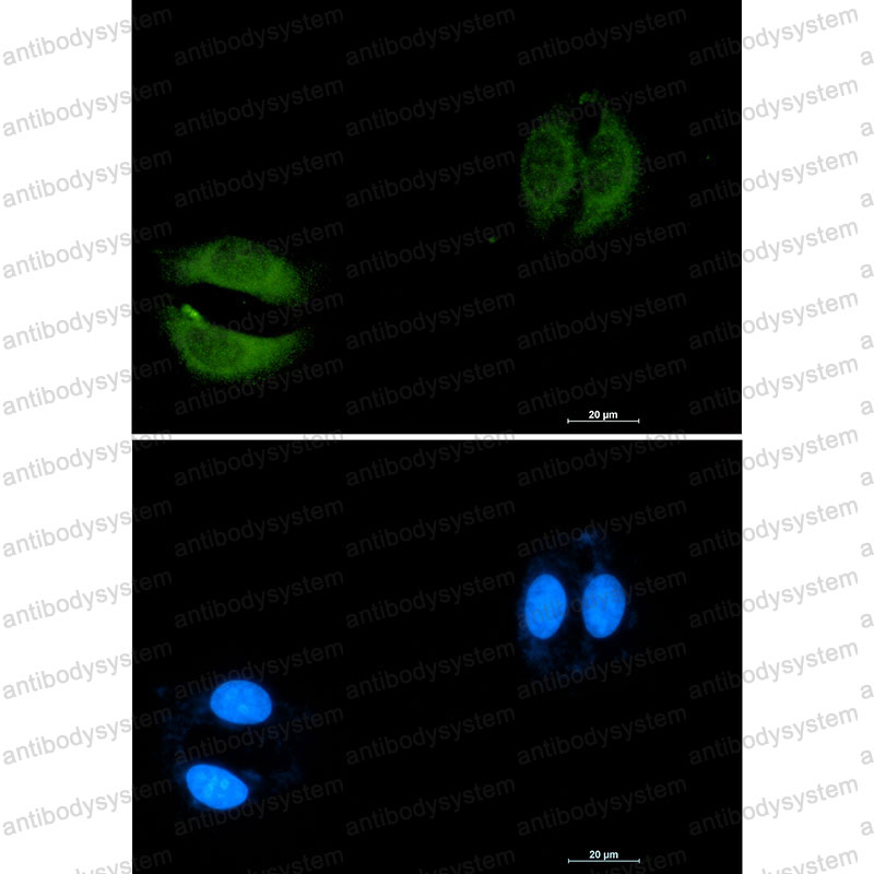 Anti-RAB5C Antibody (R1Y17)
