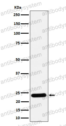 Anti-RAB5C/RABL Antibody (R1Y16)