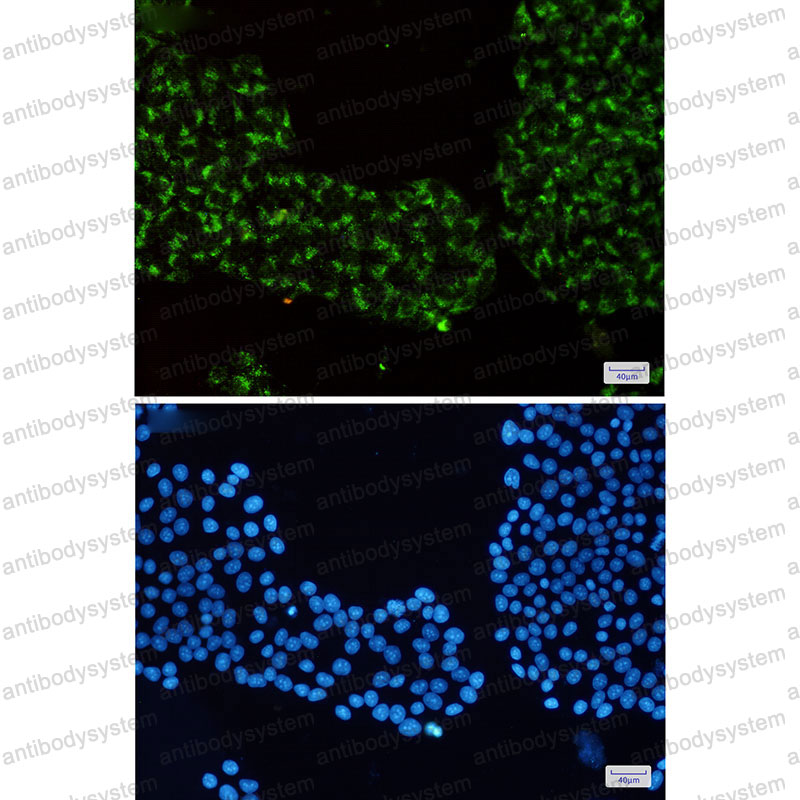 Anti-RAB7A Antibody (R1Y19)
