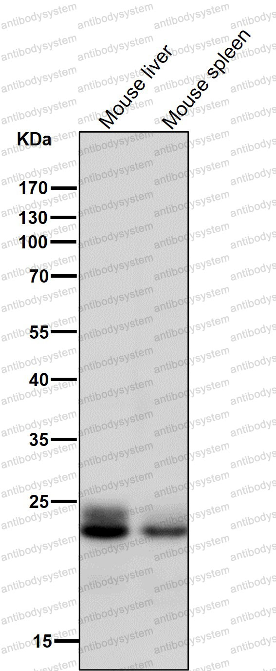 Anti-RAB9A Antibody (R1C31)