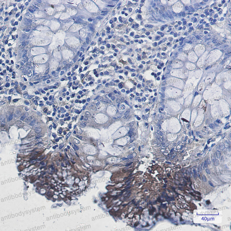 Anti-RAB9A Antibody (R1Y20)