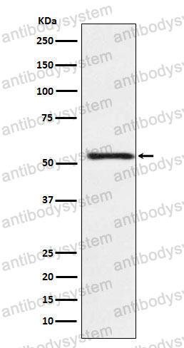 Anti-ATP4B Antibody (R1Y21)