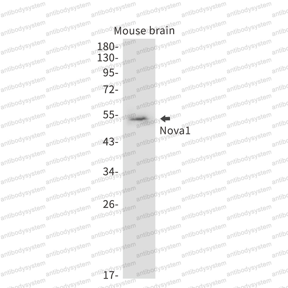 Anti-NOVA1 Antibody (R1Y23)