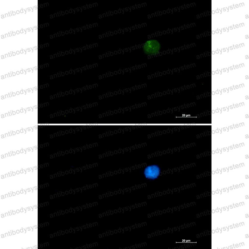 Anti-SMARCA2 Antibody (R1Y24)
