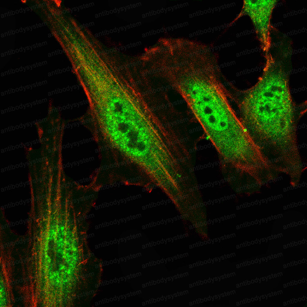 Immunofluorescence for Anti-SMARCA2 Antibody (R3M52) ?>