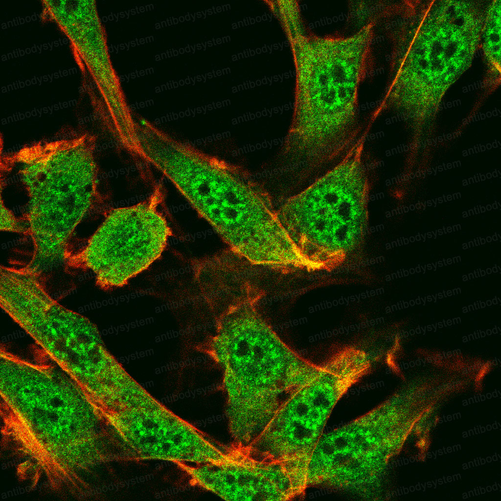 Immunofluorescence for Anti-SMARCA2 Antibody (R3M52) ?>