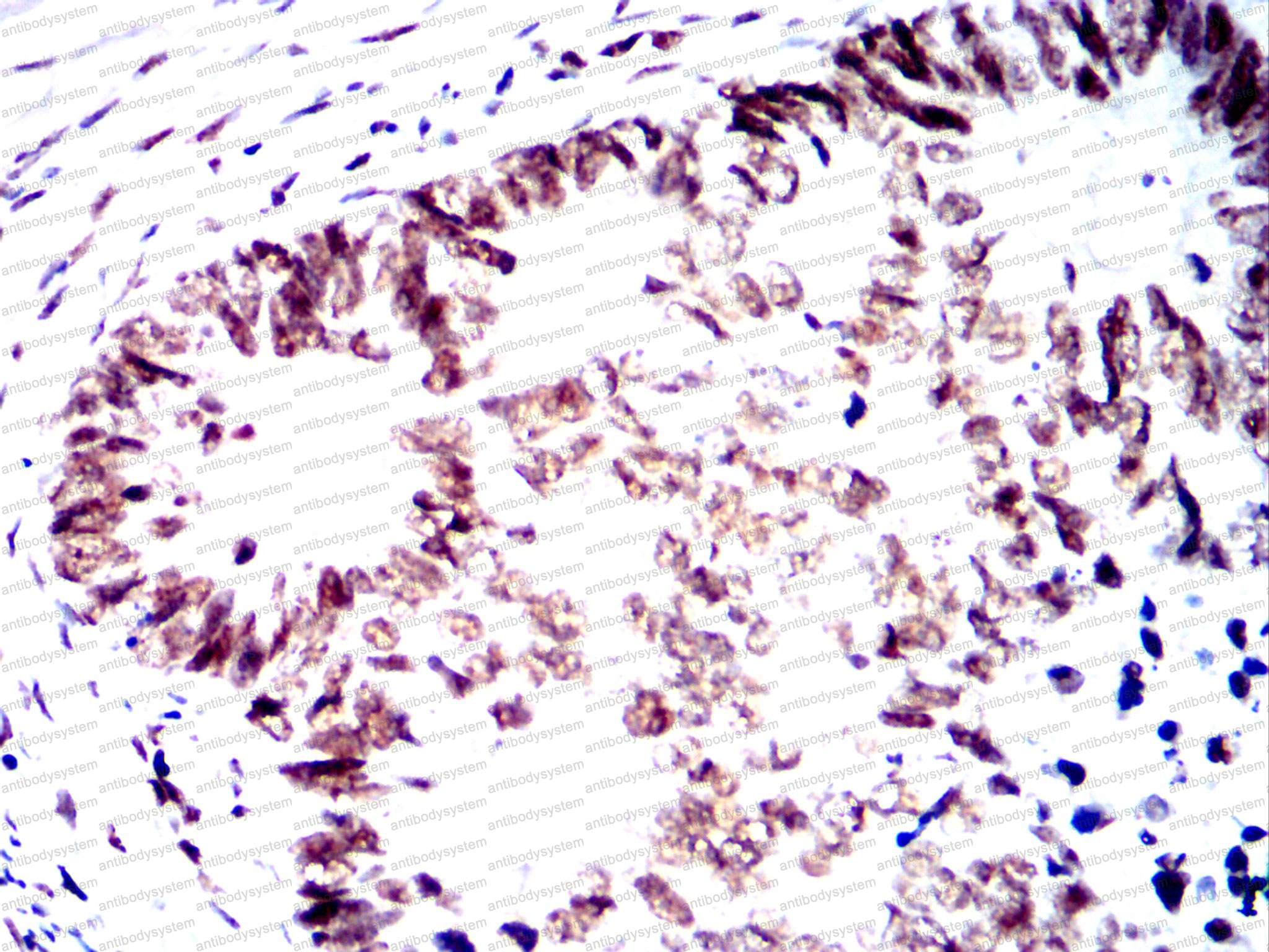 Immunohistochemical for Anti-SMARCA2 Antibody (R3M52) ?>