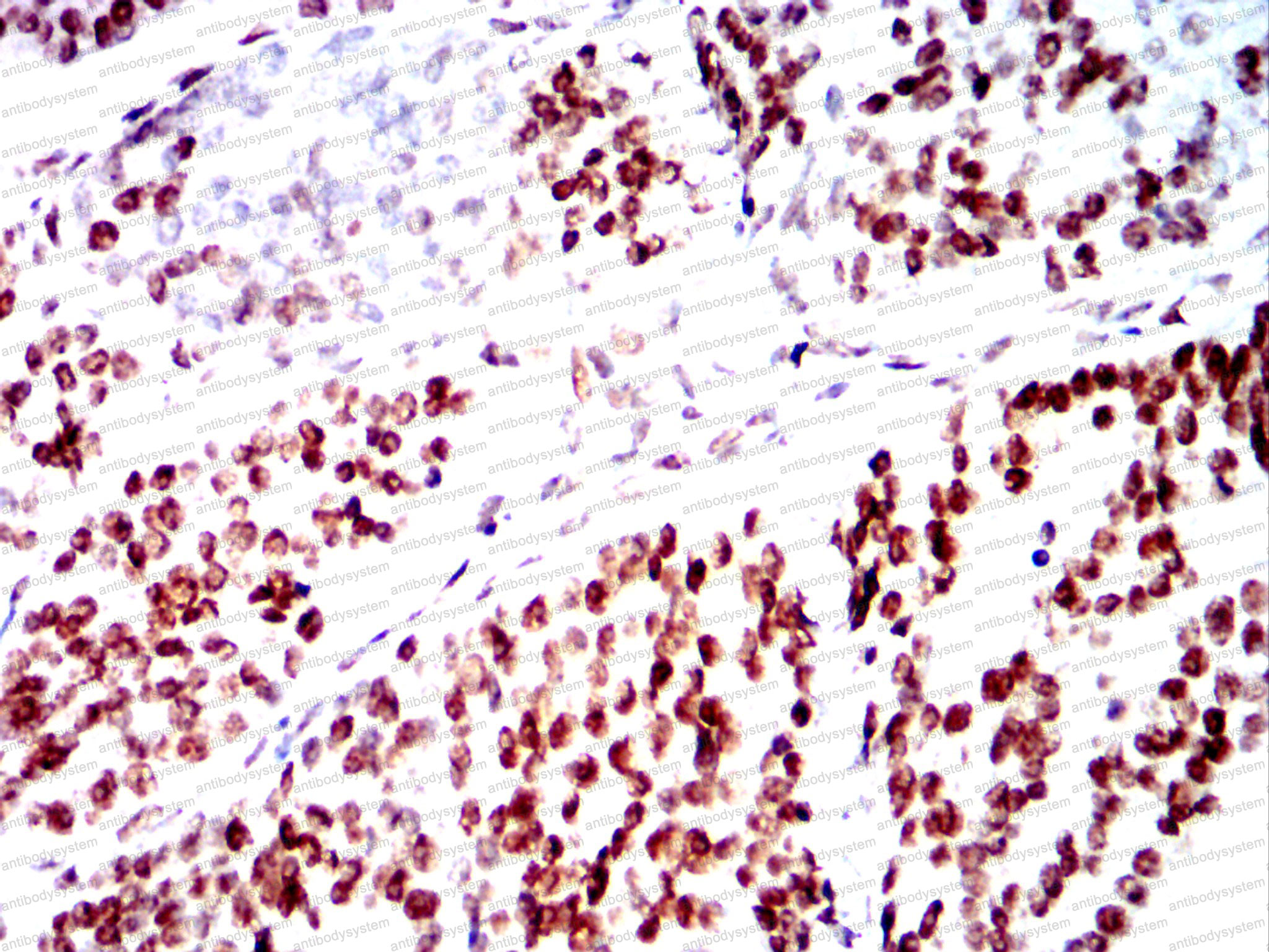 Immunohistochemical for Anti-SMARCA2 Antibody (R3M52) ?>