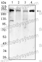 Western blot for Anti-SMARCA2 Antibody (R3M52) ?>