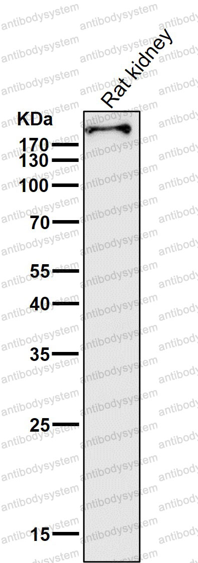 Anti-SMARCA4/BRG1 Antibody (R1Y25)