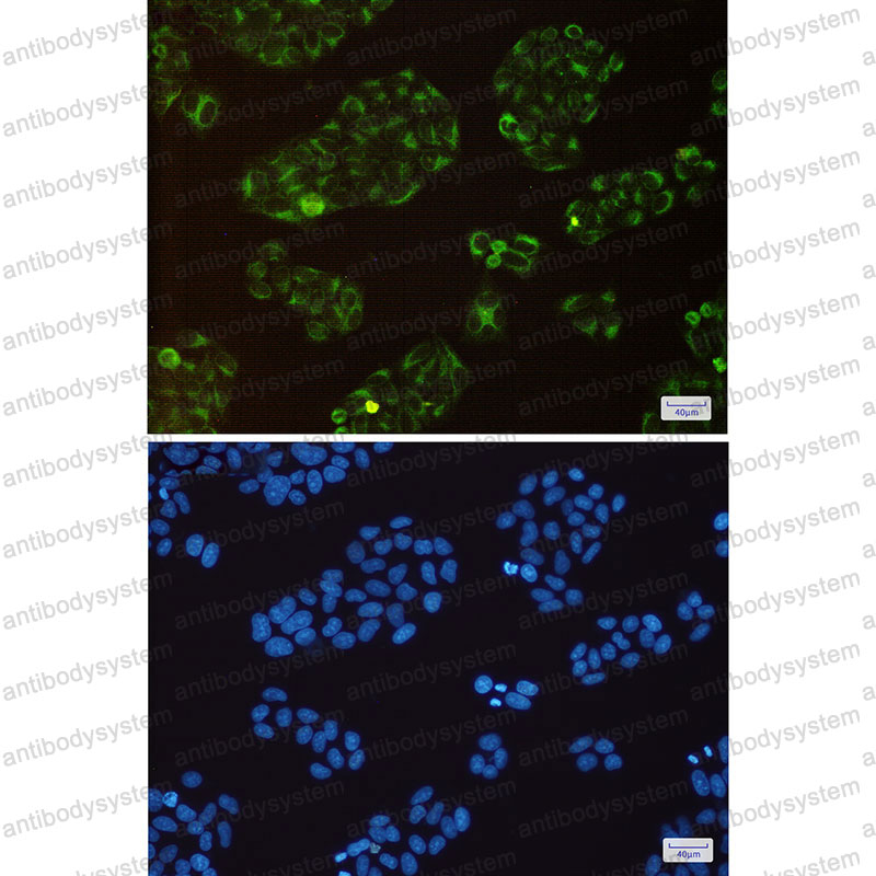 Anti-BCAP31 Antibody (R1Y28)