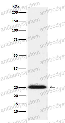 Anti-BCAP31 Antibody (R1Y27)