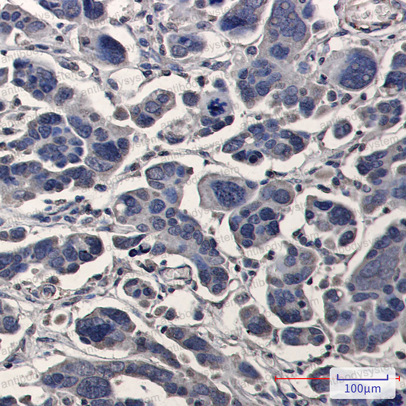 Anti-TPMT Antibody (R1Y30)