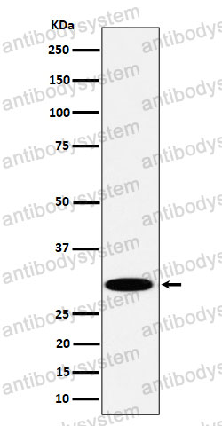 Anti-TPMT Antibody (R1Y29)