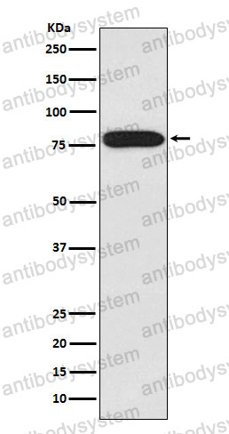 Anti-IRAK1 Antibody (R1Y31)