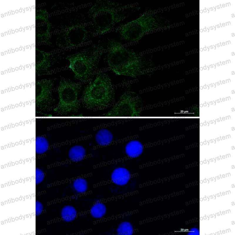 Anti-CAV2 Antibody (R1Y32)